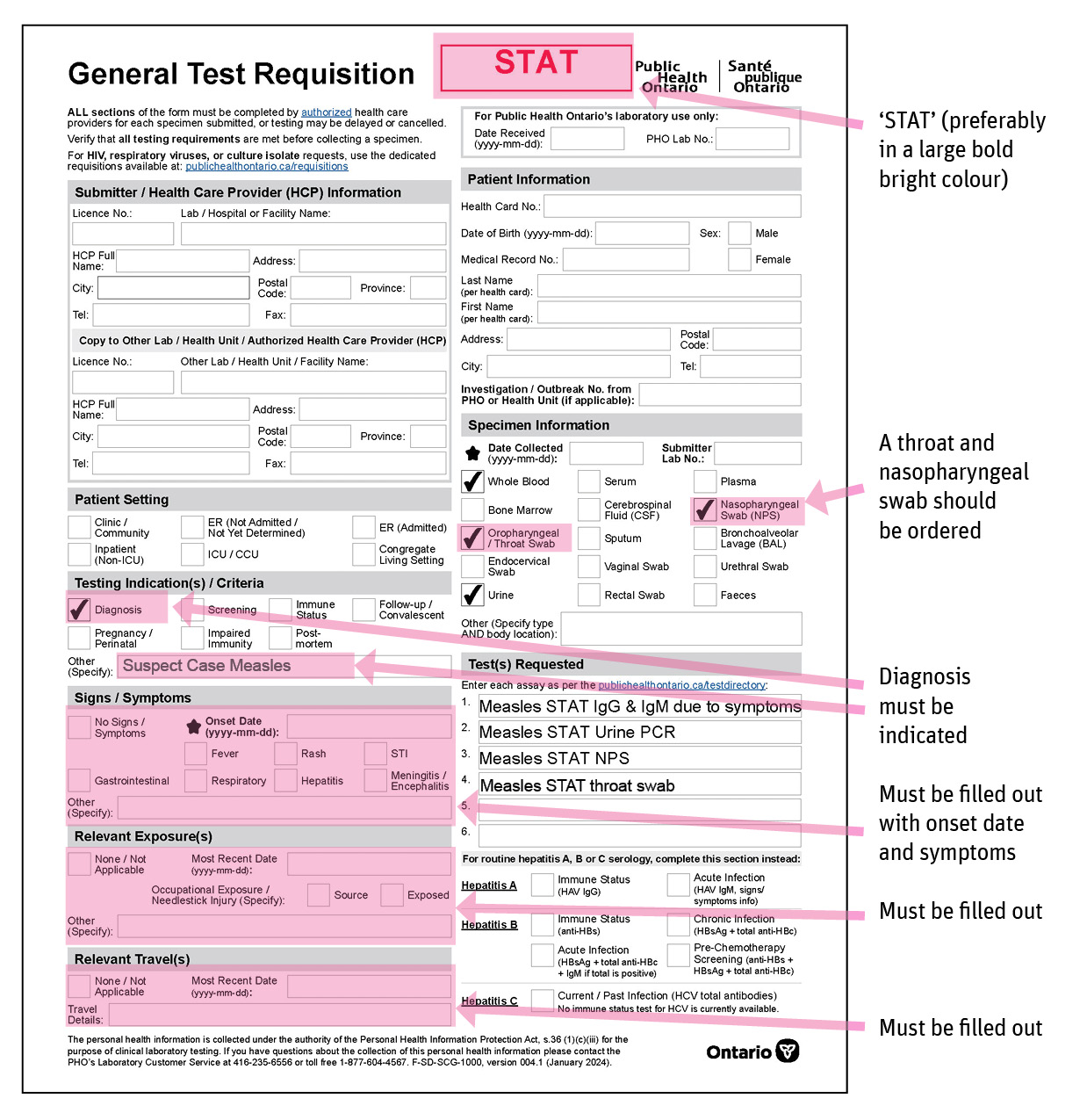 Sample measles requisition form.